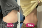 Light Therapy Belt